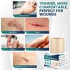 Medical Grade Hydrocolloid Roll for Wound Care