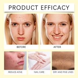 Pure Vitamin E Oil for Skin and Face 2PCS - Jojoba Oil For Hair - Nourishing Body Oil for Deep Hydration - Vitamin E for Scars-Anti-Aging and Firming Skin - Non-Greasy, Cold Pressed Body Skin Care