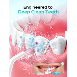 COSLUS Portable Water Flosser for Teeth: 10 Pressure Settings Professional Water Dental Pick for Orthodontic, Braces & Sensitive Gums - Cordless for Travel Use, for Adults Teens, BPA-Free, E40