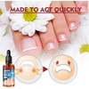 Tratamiento MFFIKOZZ para Uñas Dañadas, Engrosadas y Descoloridas de Pies