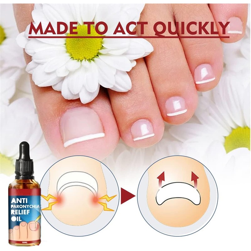 Tratamiento MFFIKOZZ para Uñas Dañadas, Engrosadas y Descoloridas de Pies
