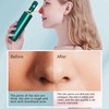 Blackhead Vacuum Suction Machine 3 Gears Magnify Pores Cleaning Electric