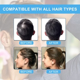 Hair Building Fibers for Thinning Hair with Spray Applicator Pump Nozzle - Natural & Undetectable,Instantly Thicker Fuller Hair Conceals Hair Loss 30 Sec,4 Shades for Men & Women,27.5g (Light Brown)