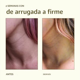 Ayadara Crepey Tratamiento reparador de la piel para brazos y piernas, crema reafirmante de ácido hialurónico para el cuello, crema antiarrugas para l
