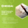 Hexeal Screenwash -5⁰C | 10L | All Seasons Screenwash Effective