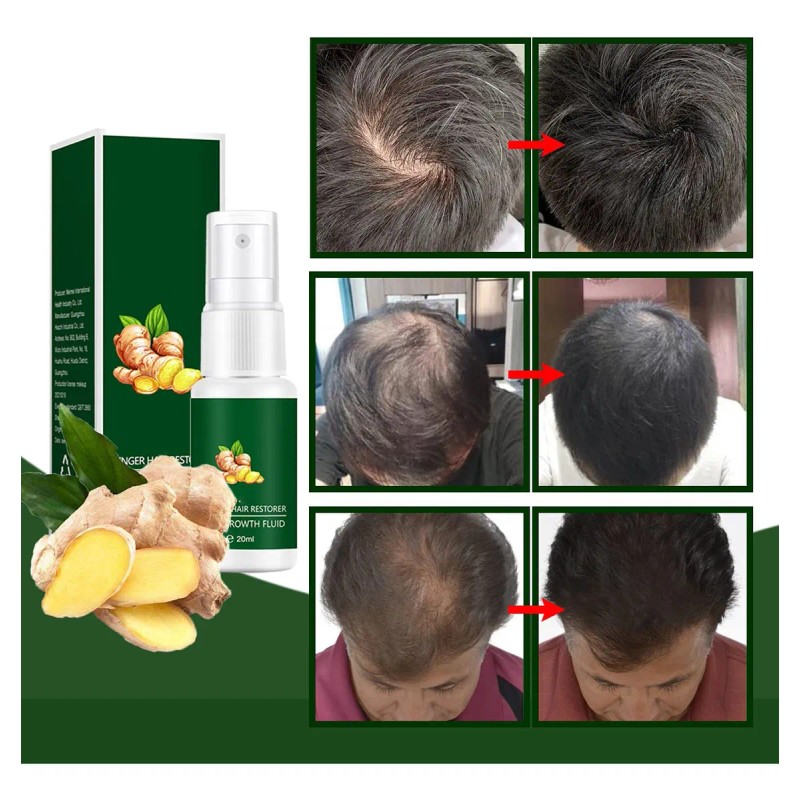 Suero De Crecimiento Del Cabello De Jengibre, Espray Nutriti