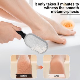 Wanheart Foot File, Foot Calluses Remover, Used for Foot Care, Effectively Removes Dead Skin, Calluses, and Cracked Skin - Black