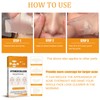 Face Acne Patches Hydrating and Purifying Forehead Nose Chin Cheek