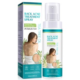 IZBEAUVO - Back Acne Treatment, Back & Body Acne Treatment For Reduce Back Spots