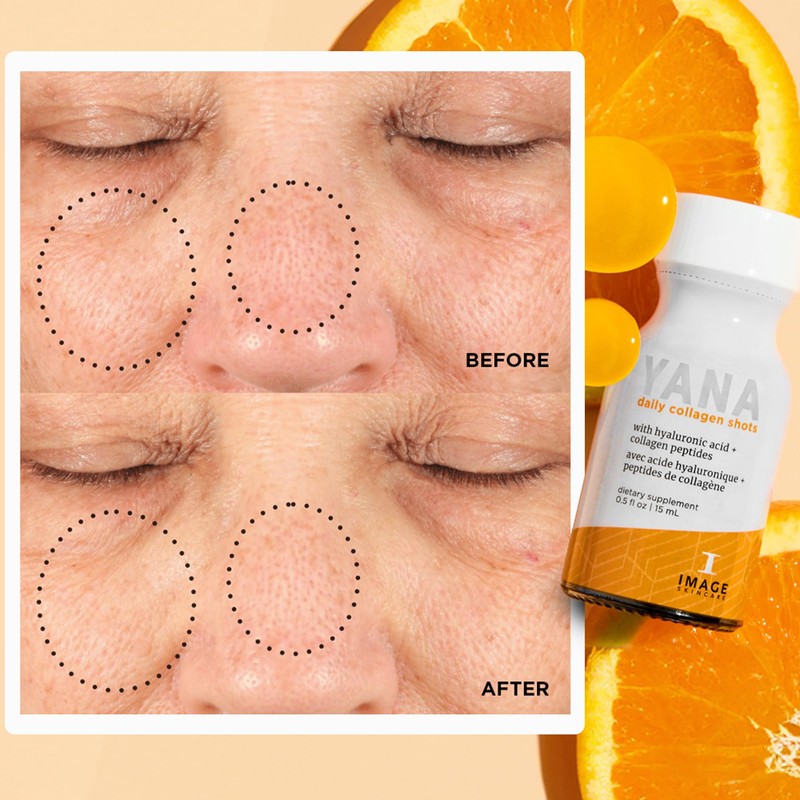 IMAGE Skincare, YANA Liquid Collagen Shots, 2500 mg Hydrolyzed Bovine