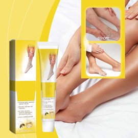 2 Stück Zoencgz Bienengiftcreme, Zoencgz Bienengift Krampfadern Creme