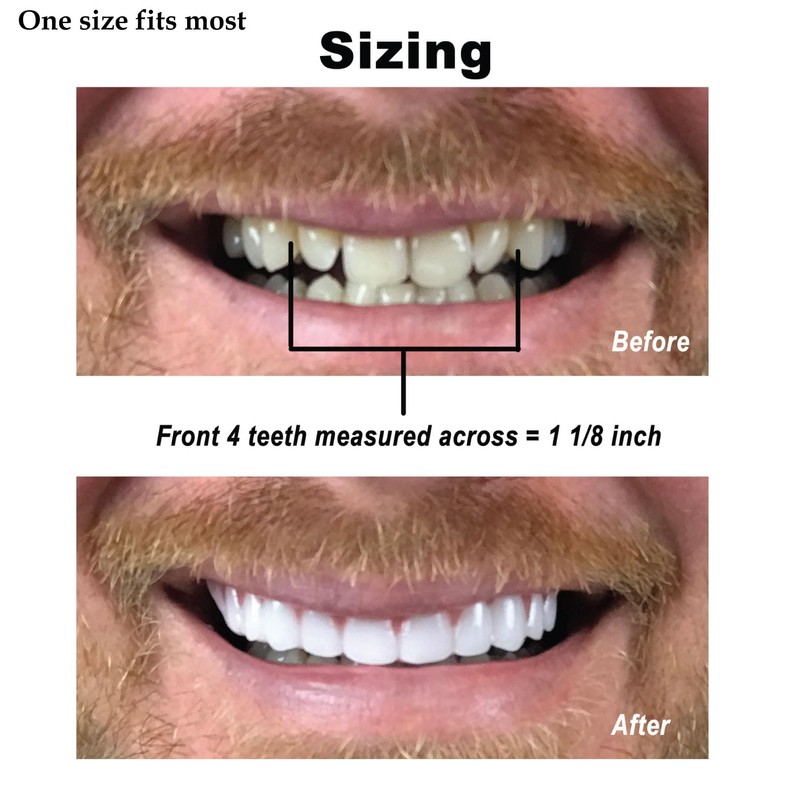Instant Smile Comfort Fit Flex - Bright Shade - Upper