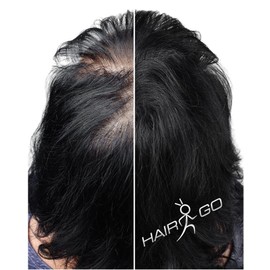 HAIR GO Premium Hair for Hair Thickening, Hair Powder, Scattered Hair, Hair Filler, Hair Loss, Hair Thickener, 100% Natural & Vegan, Pack of 1 (1 x 25 g) (White)