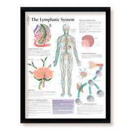 Craig Frames The Lymphatic System Framed Medical Education Poster, 22x28 Wall Diagram