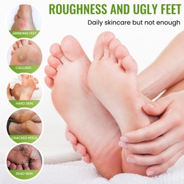 2 Paar Fußmaske Socken, Feuchtigkeitsspendende Peeling-Maske gegen Hornhaut, Sanfte Fußpflege für Männer & Frauen, Repariert Trockene und Rissige Fersen, Natürlich & Effektiv