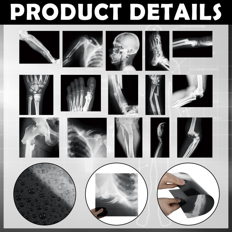 Sayglossy 15 Pcs Broken Bones X Ray Set Human X