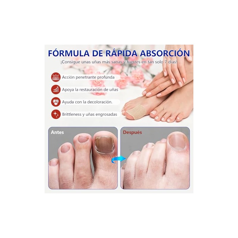 Parches Reparadores de Uñas+Tratamiento de Uñas con Esencia de Jengibre