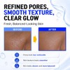 CELDYQUE- 𝙄𝙉𝙏𝙀𝙉𝙎𝙀 20% 𝙉𝙄𝙉𝙼𝙈𝙄𝙉𝙀𝙎: Fortalece la barrera cutánea, reduce visiblemente