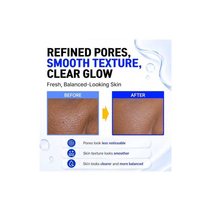 CELDYQUE- 𝙄𝙉𝙏𝙀𝙉𝙎𝙀 20% 𝙉𝙄𝙉𝙼𝙈𝙄𝙉𝙀𝙎: Fortalece la barrera cutánea, reduce visiblemente