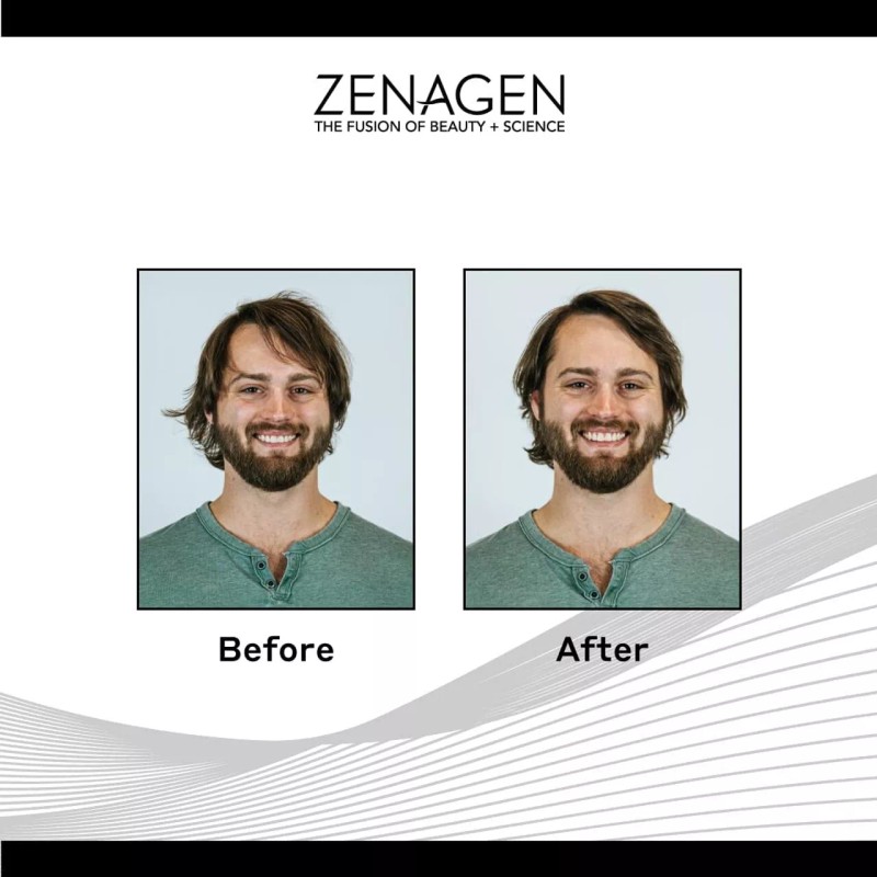 Zenagen Crue Grit Flexture Paste 2oz (2pack)