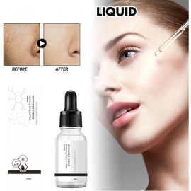 Generic Aobenz Spot Remover Serum for Face, Aobenz Remover Freckle Essence, Melasma Freckle, Sun Spot, Age Spot, Brown Spot, Spot Corrector Facial Serum for All Skin Types Spot for Men and Women