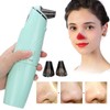 Electric Hot Compress Blackhead Acne Removal Machine Face Pore Cleaner