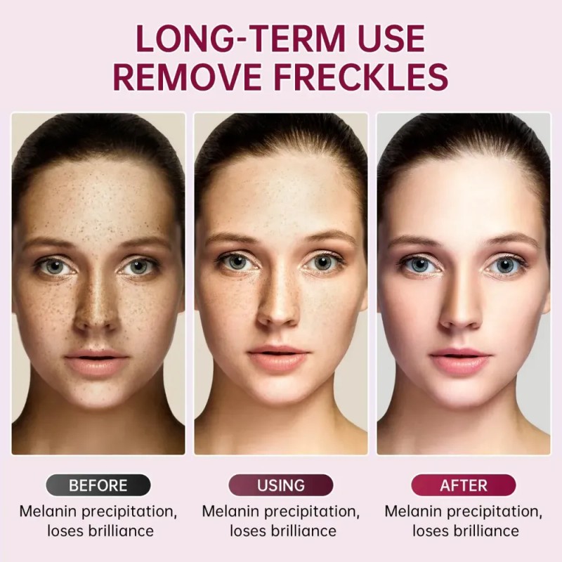 Crema Facial Despigmentante Houmai 20g Todo Tipo De Piel