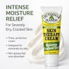 Outdoor Hands Intense Skin Therapy Cream – Crack & Dry