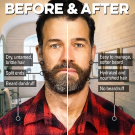 Gnarly Joe Beard Shampoo for Men - 100ml - Moisturise and Soften African Black Soap - Shea Butter - Coconut - beard wash for men - beard soap - Beard Dandruff Shampoo (Shea Butter and Coconut)