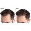 KHENZ Tea Tree Shampoo 300ml Prevents Hair Loss Soothes Irritation