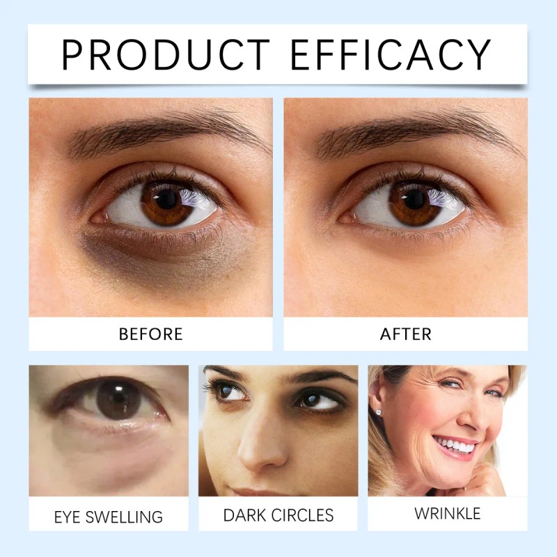 Gel Refrescante Contorno De Ojos Hidratante Antiarrugas 15g
