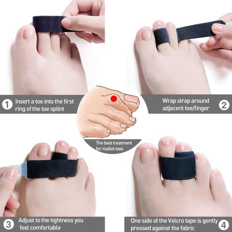 Welnove Broken Toe Splint Elasticity Corrector Braces - Set of