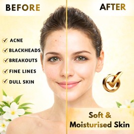 Tea Tree Oil & Jasmine Soap Blemished Skin Blackhead Pimple Face Soap