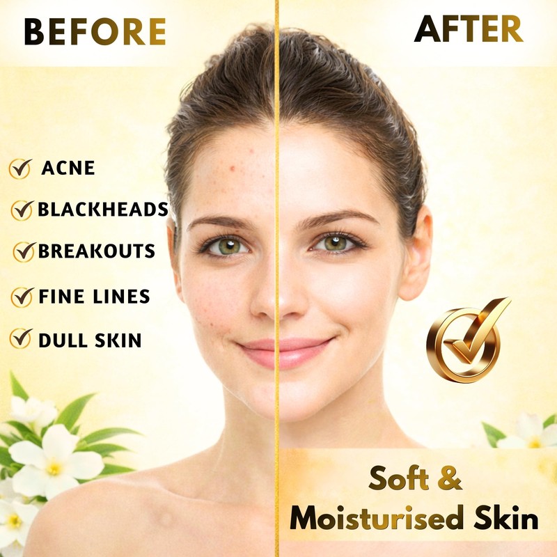 Tea Tree Oil & Jasmine Soap Blemished Skin Blackhead Pimple