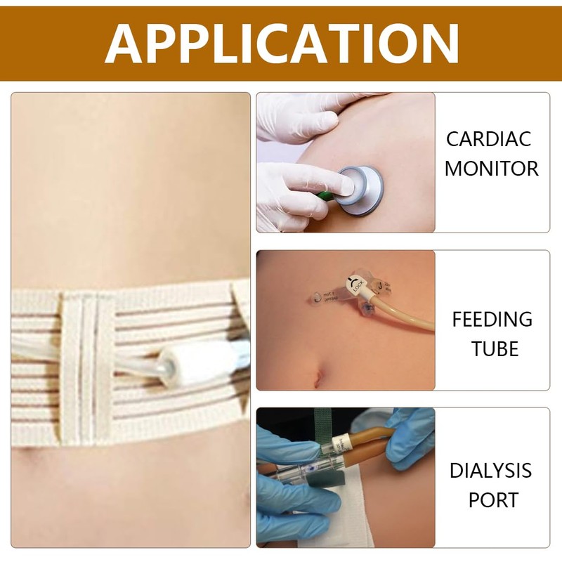 SGERUFZ 1 x Peritoneal Dialysis Belt, Abdominal Dialysis Belt, Breathable,