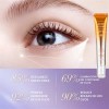 Crema Contorno De Ojos Con Retinol Antiarrugas Roll On 20g