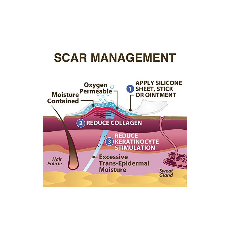 Scar Aid - Barra de silicona para tratamiento de cicatrices,
