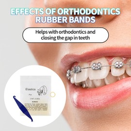 500 Pcs 1/4 Inch Orthodontic Elastic Rubber Bands, 5 Pack Free Elastic Placer for Braces, Medium 3.5 Ounce Rubberbands Dreadlocks Hair Braids Fix Tooth Gap, Dental Rubber Bands