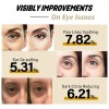 Advanced Snail Peptide & Collagen Eye Cream (2pcs) – Reafirma,
