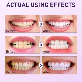 Eliminación De Manchas Polvo Blanqueador Dientes Uva Menta