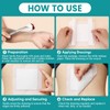 50 Count Island Dressing Bordered Gauze 6" x 6", Gauze