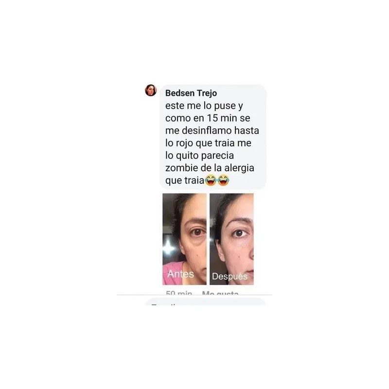 Gel Vitaminado Disminuye Ojeras & Desinflama Sheló Nabel