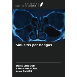 Sinusitis por hongos