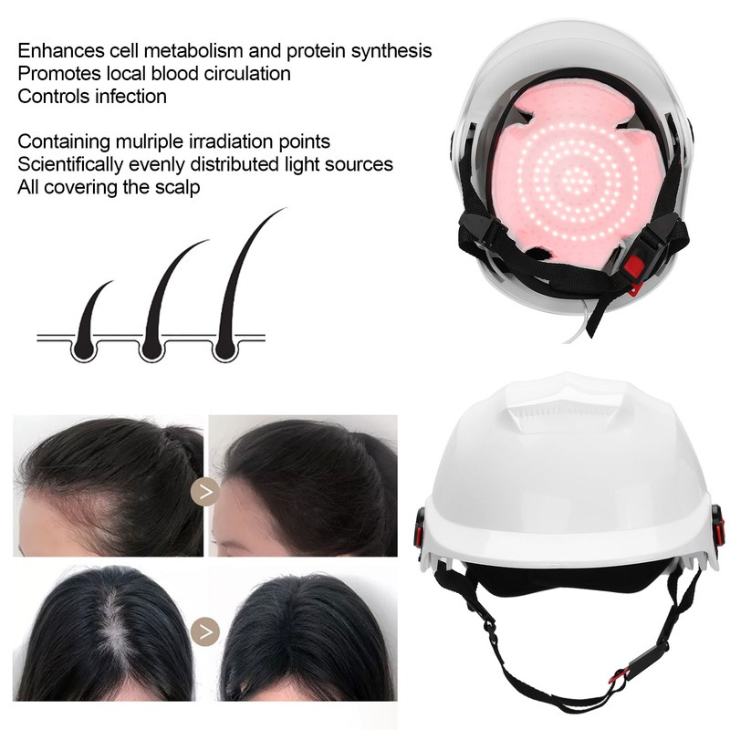94pcs Lamp Beads Red Light Therapy Hair Loss Treatment Device