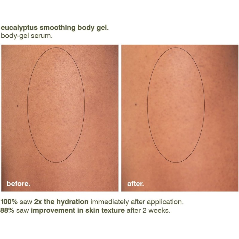 Eucalyptus Smoothing Body Gel by Malin + Goetz for Unisex