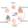 PEDIMEND™ Bunion Splint with Adjustable Strap (1PCS) - Bunion Aid