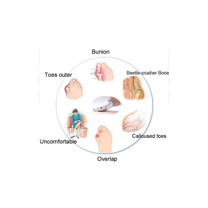 PEDIMEND™ Bunion Splint with Adjustable Strap (1PCS) - Bunion Aid