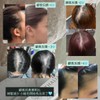 ATHALIA Hair Growth Essence FAST & EFFECTIVE [ Anti-Hair Loss,