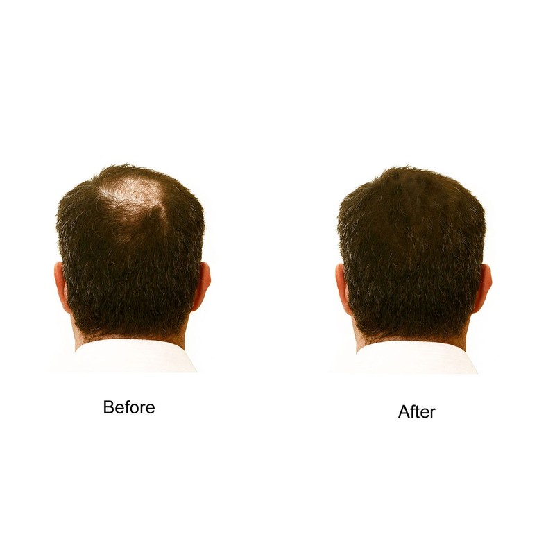 My Secret Correctives Hair Enhancer for Fine/Thinning Hair - 5