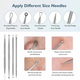 Unbranded Blackhead Remover Tool Kit with Diagonal Tweezers - Pimple & Lump Popper Set